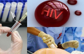 Chế độ đối với người bị nhiễm HIV/AIDS do tai nạn rủi ro nghề nghiệp